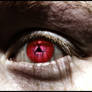 Infected Eye