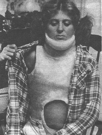 Fiber risser cast by chebhasni on DeviantArt