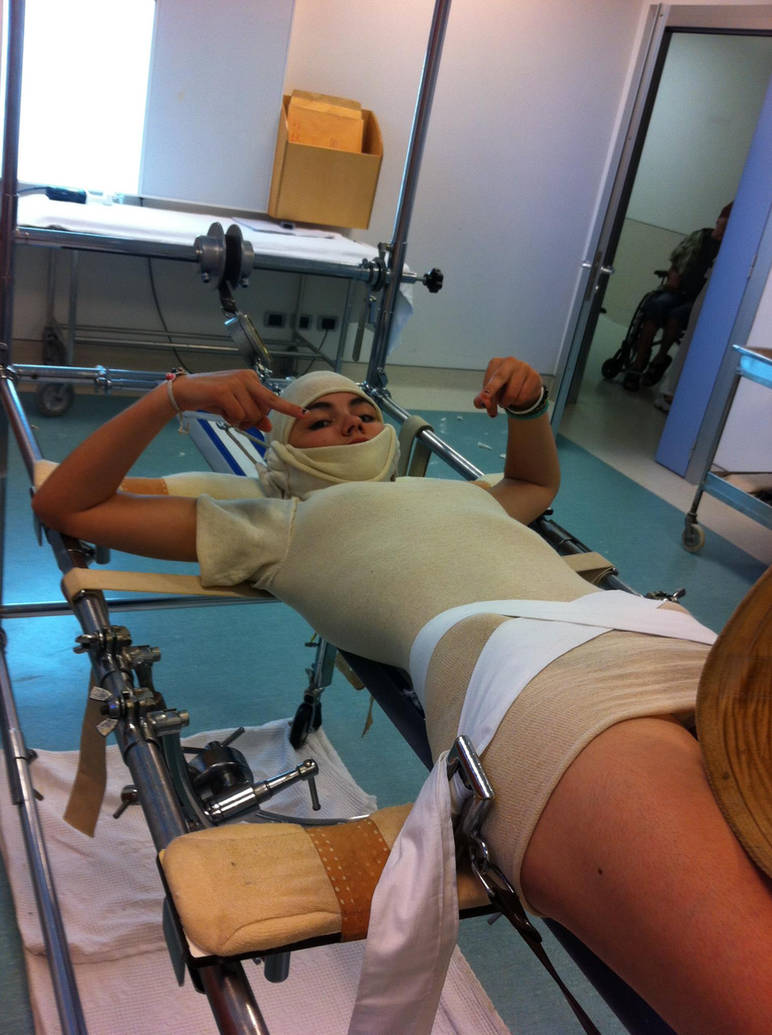 First Body Cast Body cast session 6 by chebhasni on DeviantArt