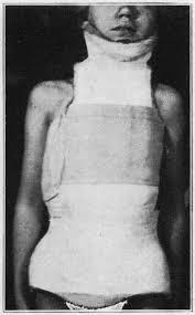 Vintage body cast by chebhasni on DeviantArt