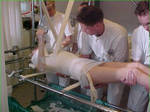 Body cast session 16