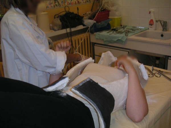 First Body Cast Body cast take off 2 by chebhasni on DeviantArt