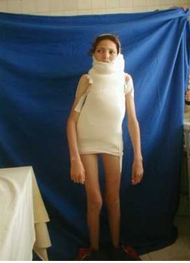 First Body Cast Cumbersome body cast by chebhasni on DeviantArt