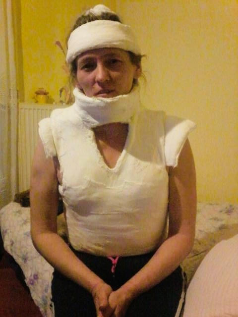 Body cast, I guess recreational by chebhasni on DeviantArt