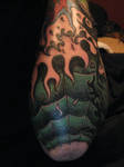Redo - My Arm and Elbow