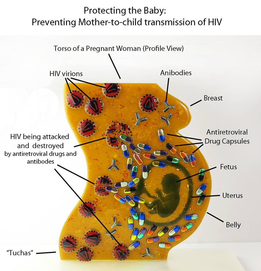 Preventing Mother Child Transmission Of HIV By Trilobiteglassworks On preventing-mother-child-transmission-of-hiv-by-trilobiteglassworks-on