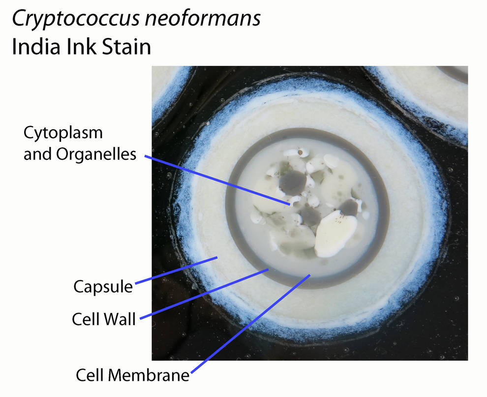 Cryptococcus neoformans with India Ink Stain Glass by ...