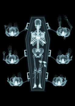 X-Ray Dead