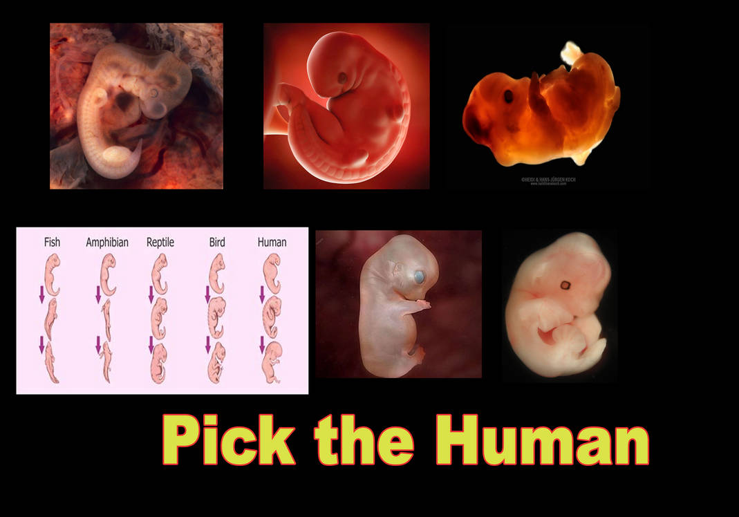 Human Pick Pick the Human by neoTall on DeviantArt