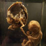 Human Foetus