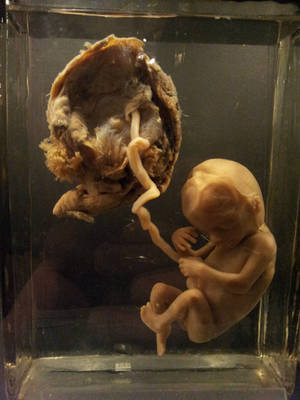 Human Foetus by BlokkStox Human Foetus by BlokkStox