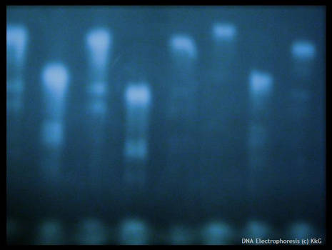 DNA Electrophoresis