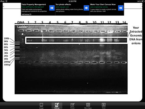 gel electrophoresis 2