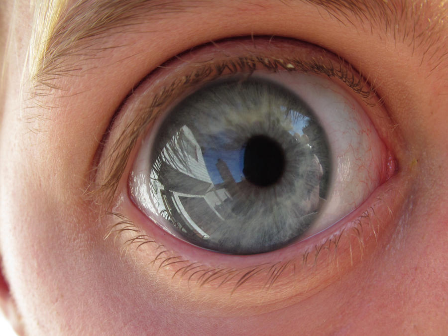 My eye explosion by Matthew-Fuller on DeviantArt