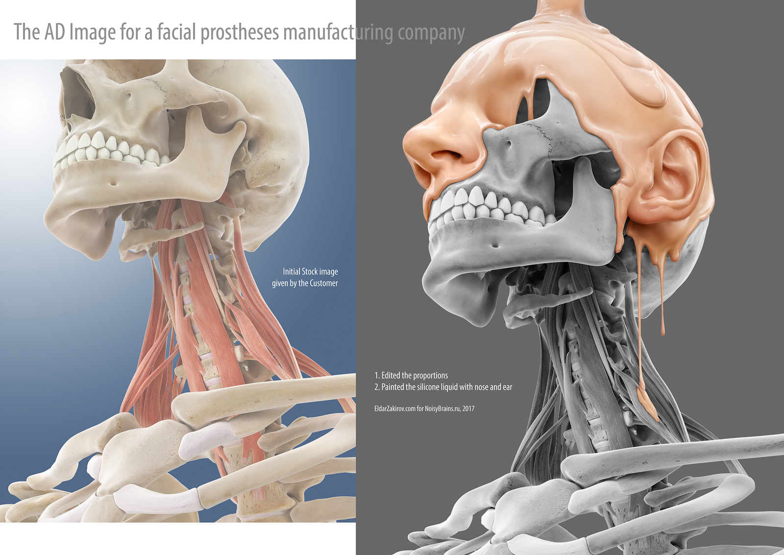 The Image for a Facial prostheses Manufacturer