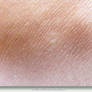Unrestricted Texture - Human Skin 2