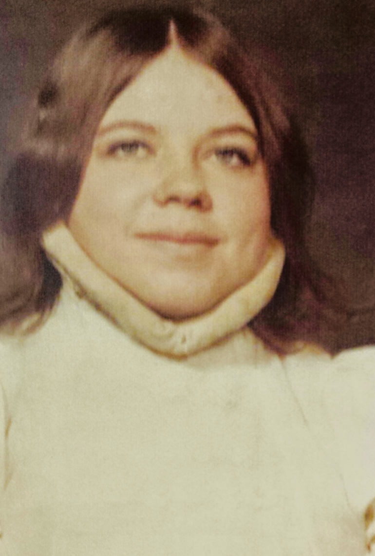 risser chin by lfitz on DeviantArt