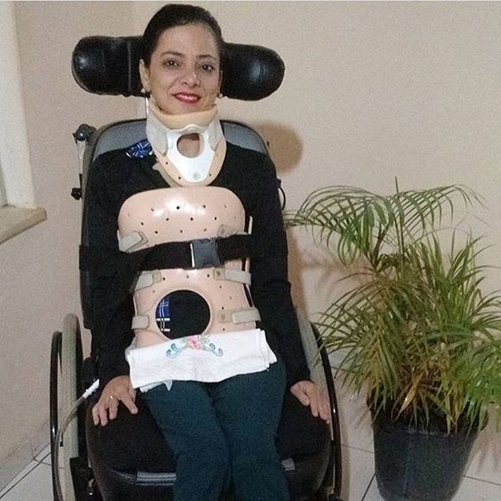 Puppet Braces body braced by lfitz on DeviantArt