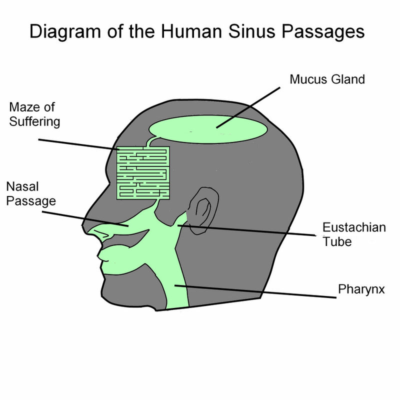 Sinus Diagram By Shininginthedarkness On DeviantArt