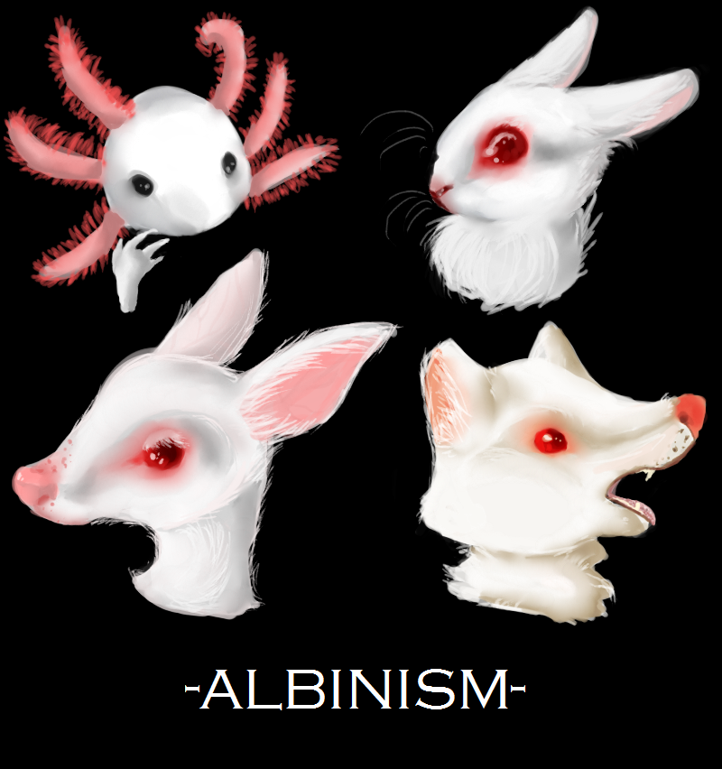 albinism