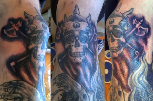 SKull knee