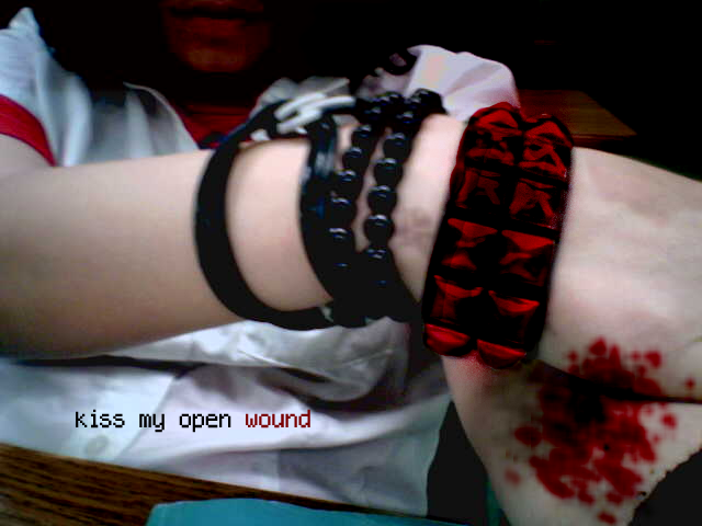 kiss my open wound
