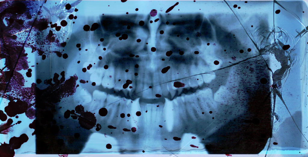 Inhuman Anatomy by exodos on DeviantArt