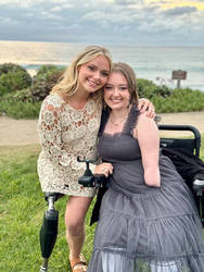 Amputee beauties