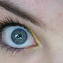 Eye stock