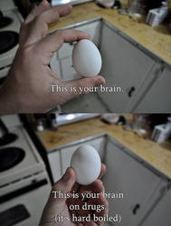 This is your brain