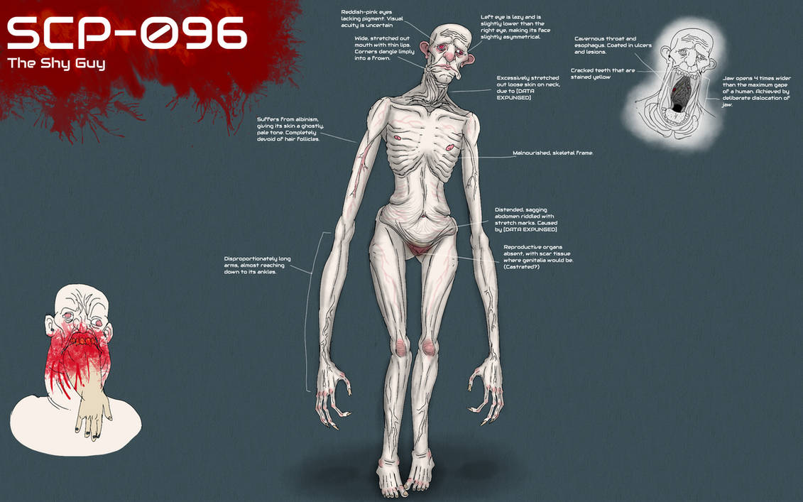 What does SCP-096 do to its victims after being caught? - Quora
