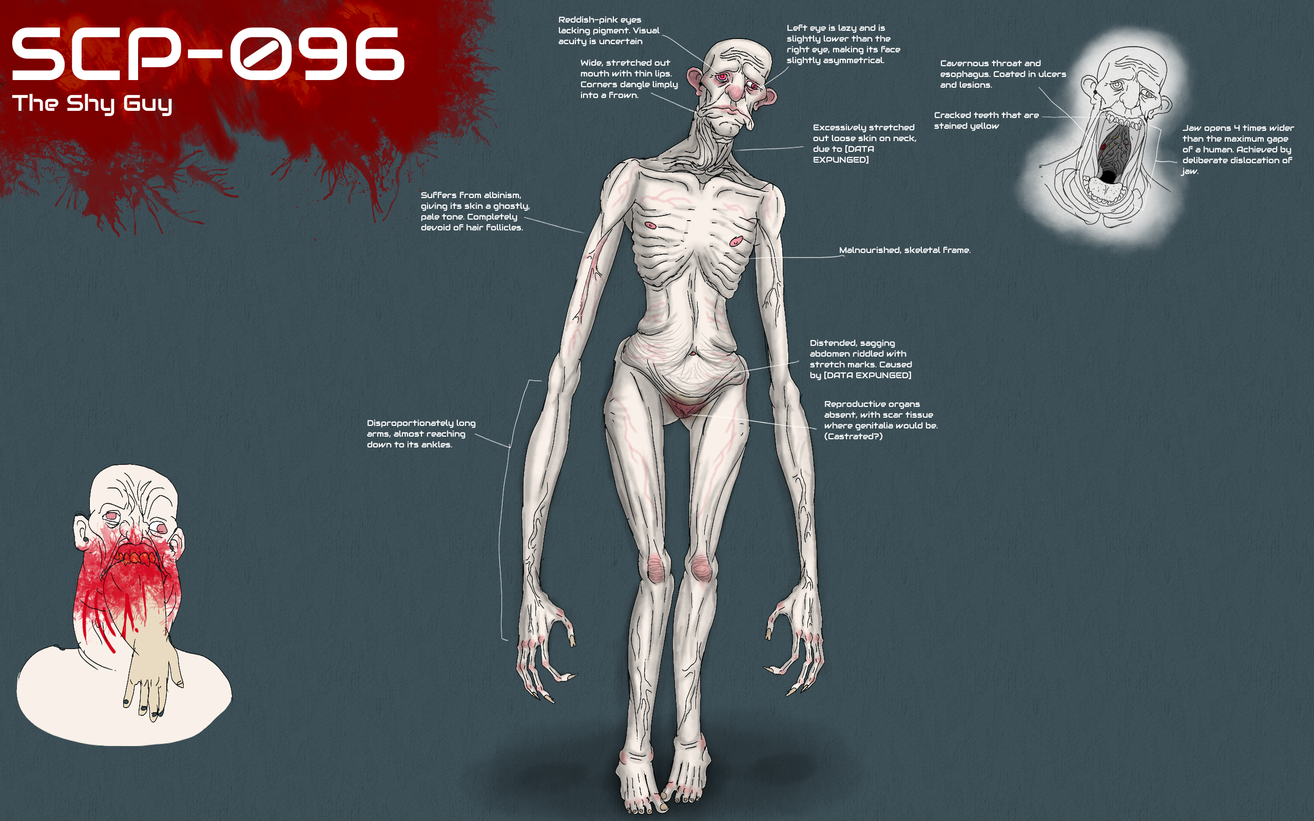 SCP-096 by Creature-Studios on DeviantArt