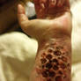 Trypophobia FX