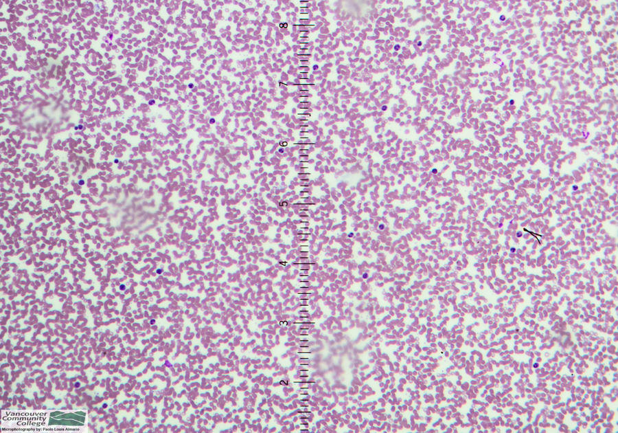 Lpo Microscope Example Human Blood Smear @ LPO Mag by Spyrogenes on DeviantArt