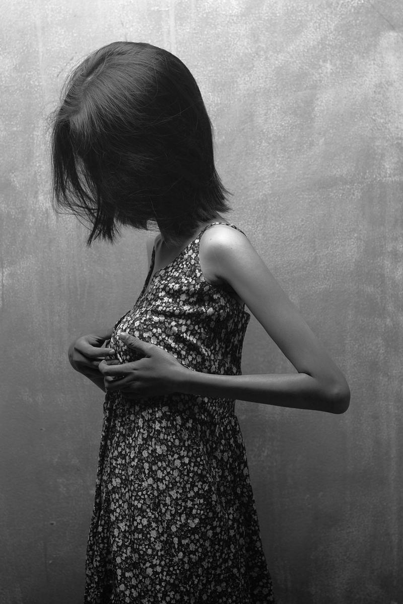 Anorexia nervosa by zokyzoker on DeviantArt Anorexia nervosa by zokyzoker on DeviantArt