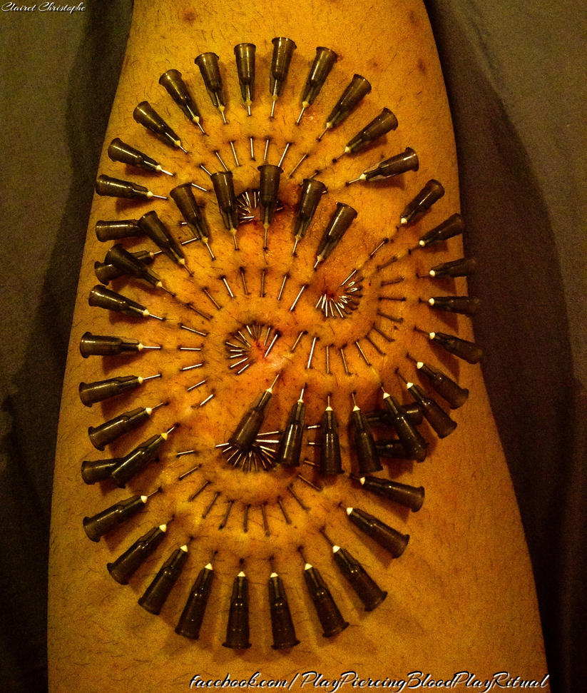 Прокалывание члена иглами