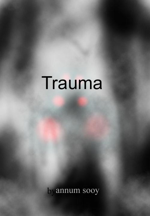 Trauma cover