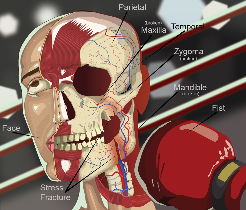 Anatomy Project - Dude getting punched in the Face