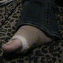 Broken Foot I