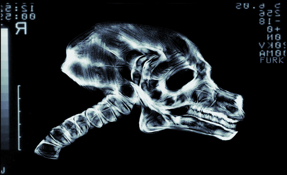 werewolf x ray
