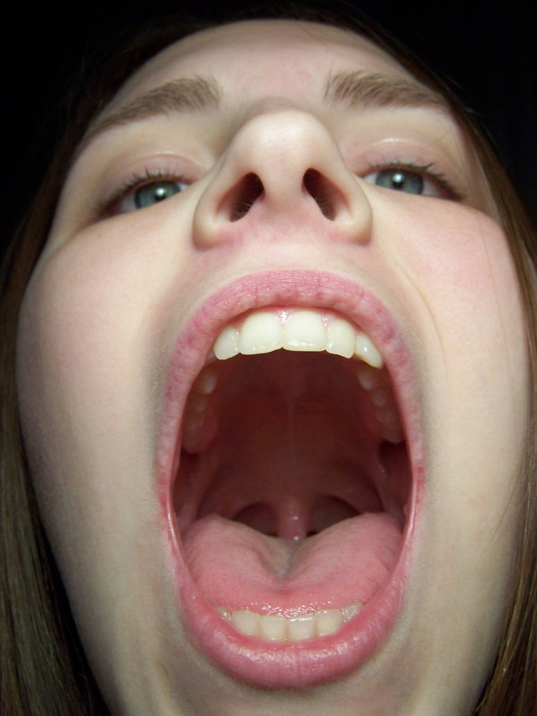 Say AHHHH by Della-Stock