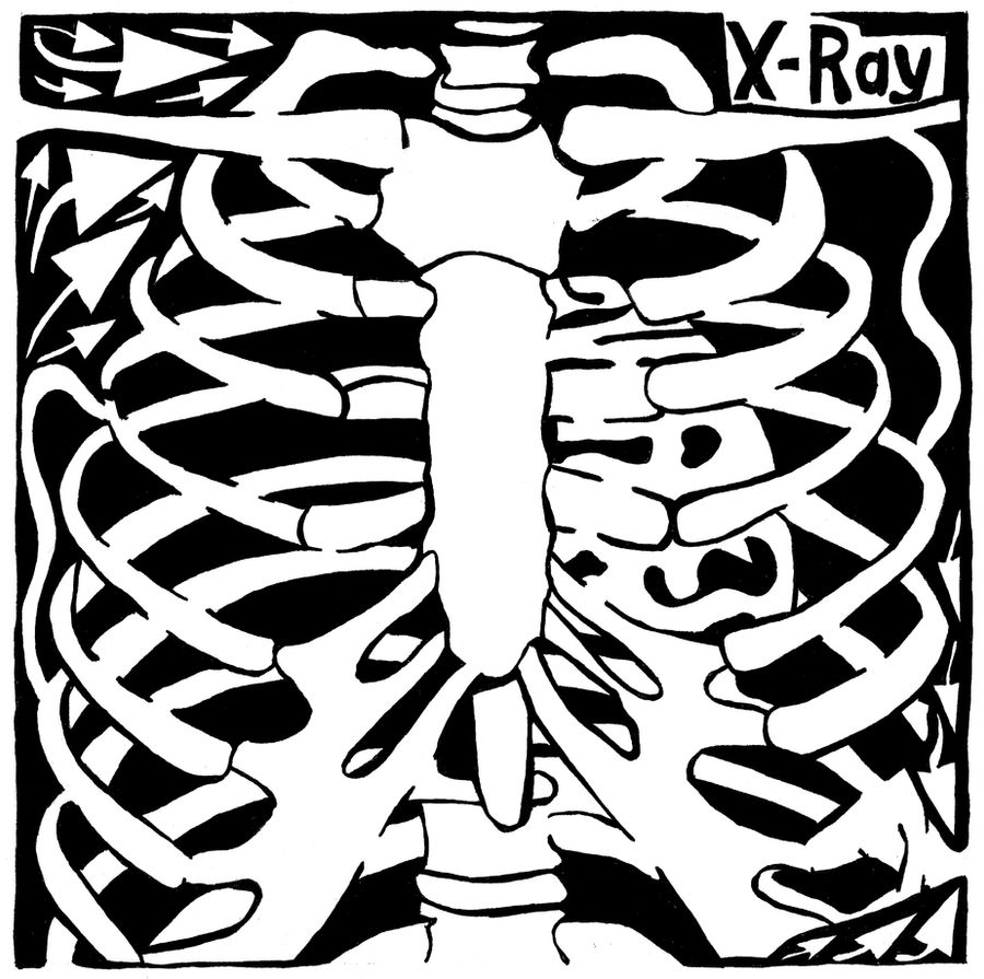 X-Ray Maze by ink-blot-mazes