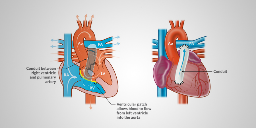 Rastelli by birlaheart on DeviantArt