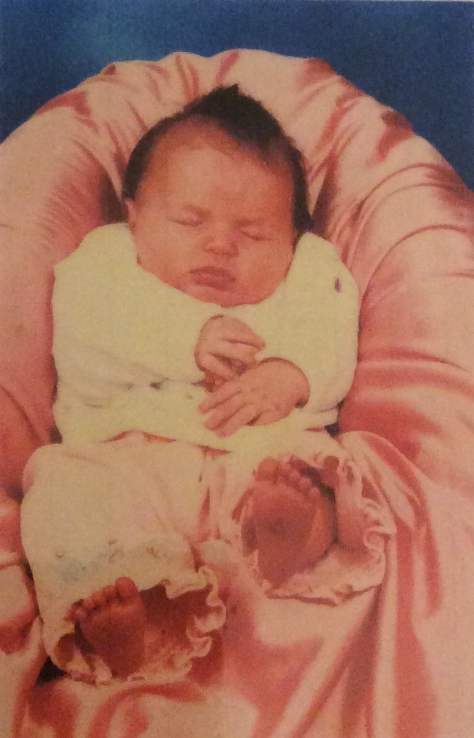 Me at 2 weeks old