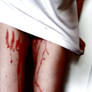Rape