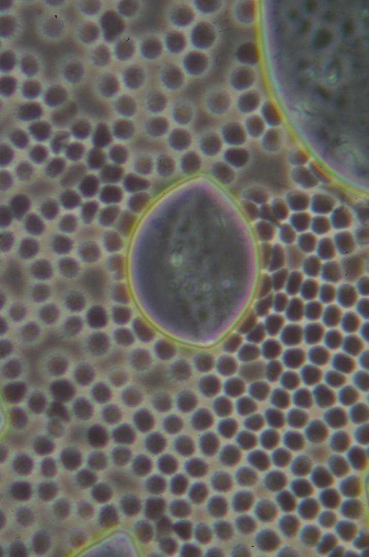Phase Contrast Rbcs Red, White Blood Cells using Phase Contrast by Crixans on DeviantArt