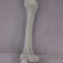 Skeleton Arm