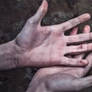 Damaged Hands Photograph