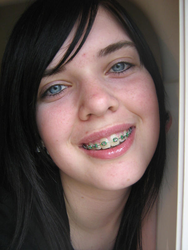Brap Face Brace face by CrazyVampireLover on DeviantArt