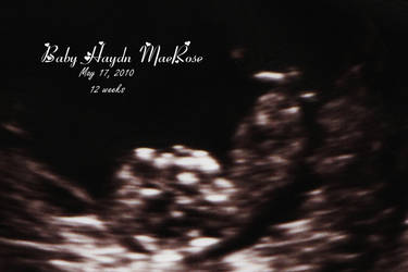 Baby Haydn MaeRose- Ultrasound